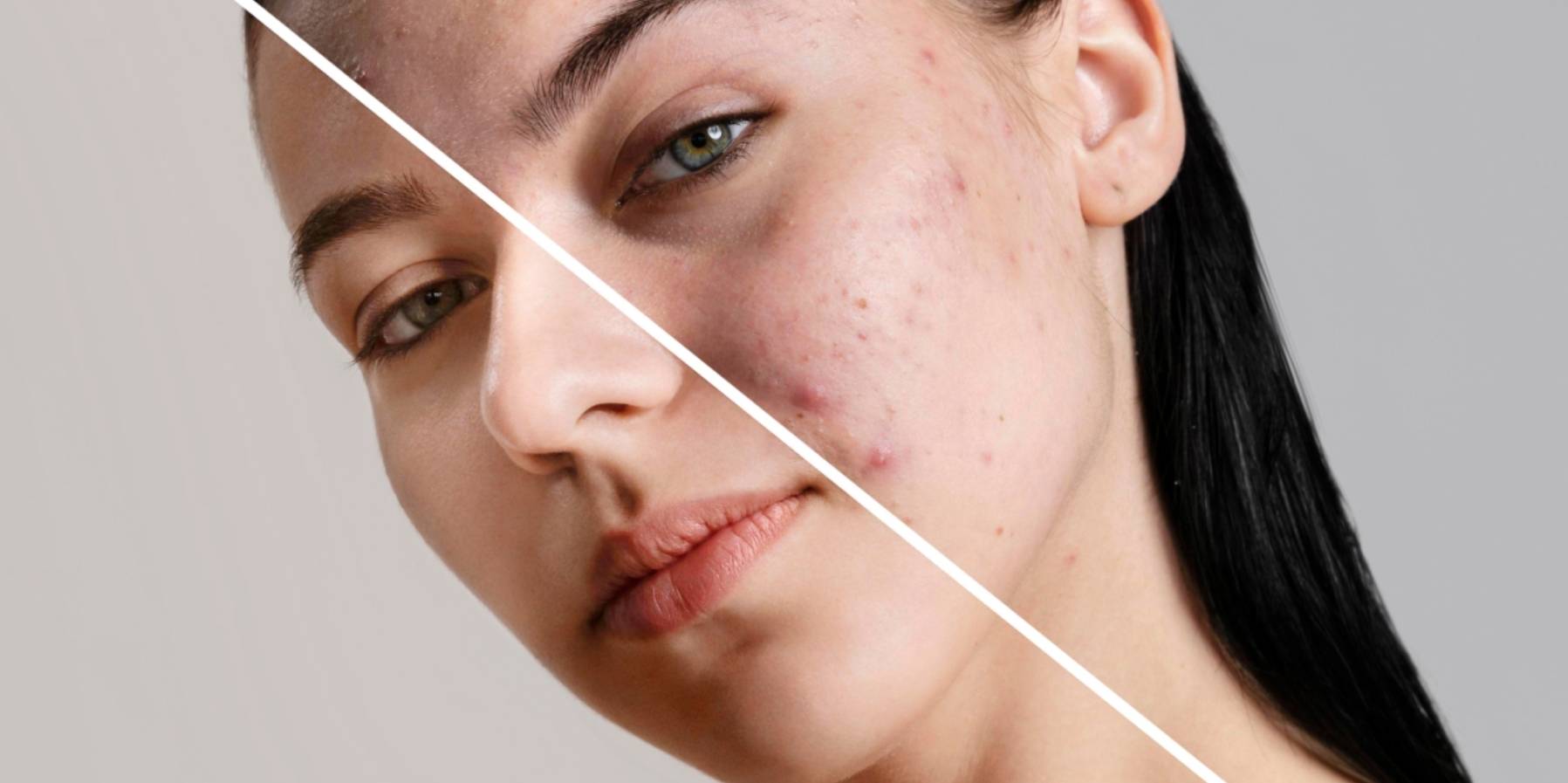 What Does Sensitive Skin Mean? : Explained