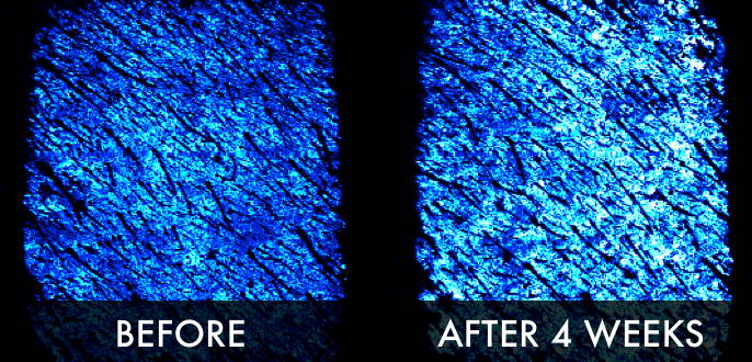 Clinical trial image