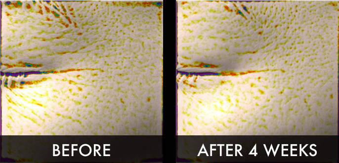 Clinical trial image