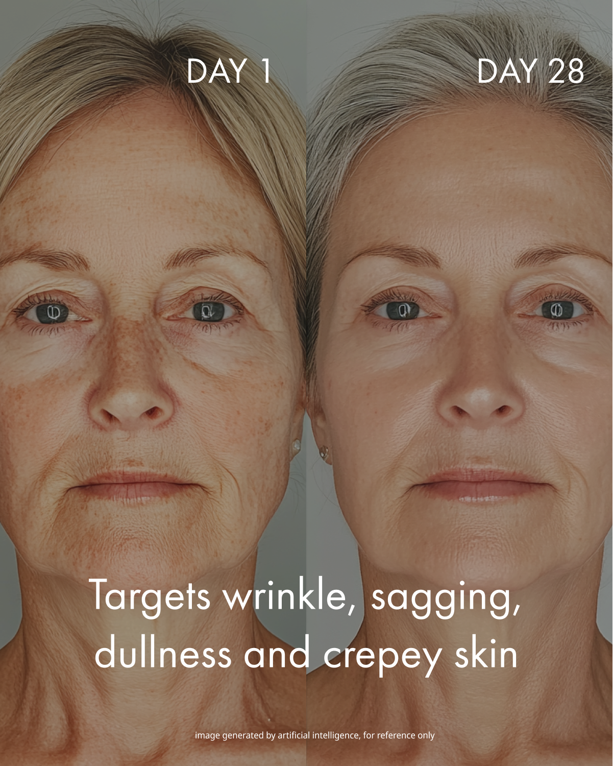 The "Micro-needling in a jar" Cream