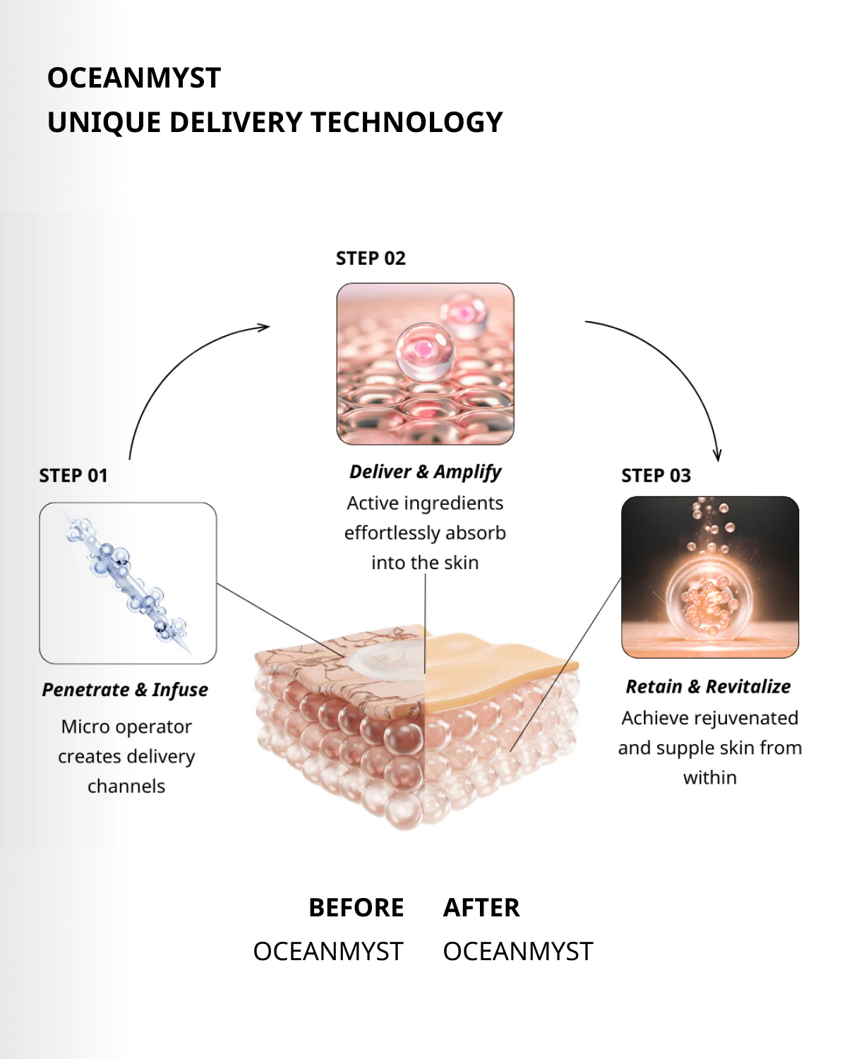 The "Micro-needling in a jar" Cream