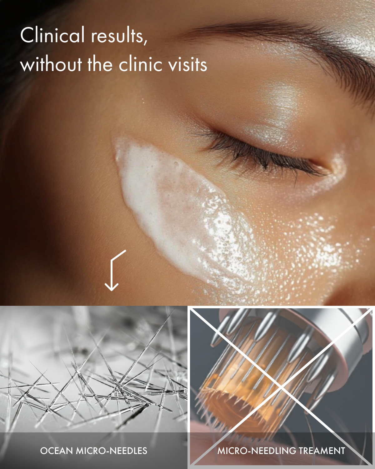 The "Micro-needling in a jar" Cream