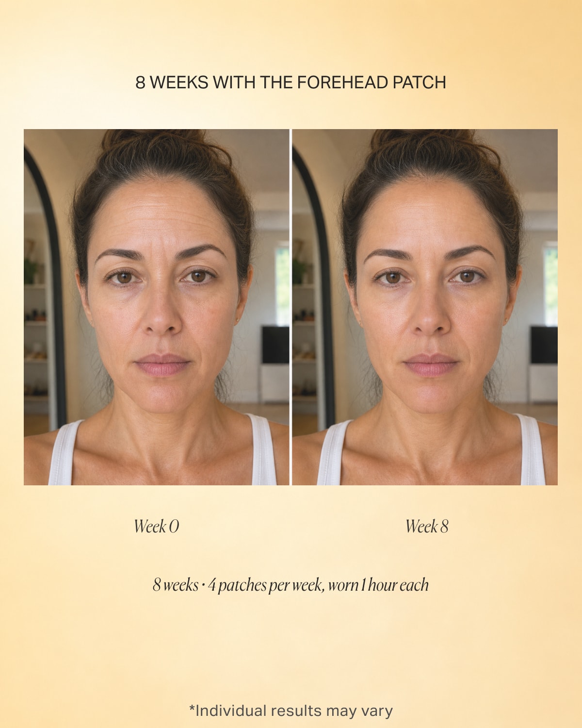 Deepcare+® Retinol-Infused Forehead Micro Dart Patches