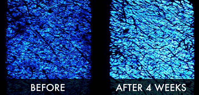Clinical trial image