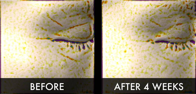 Clinical trial image