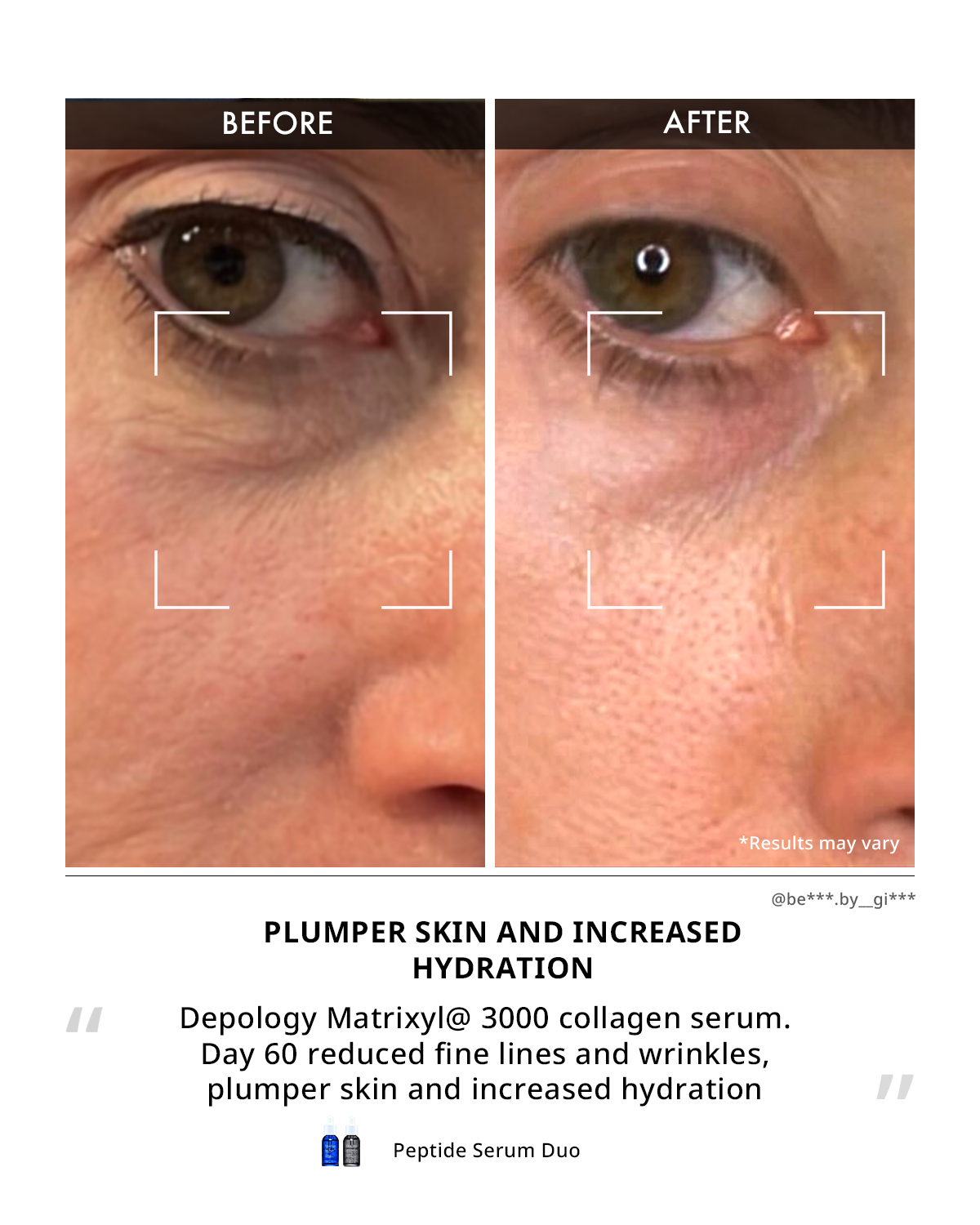 Matrixyl® 3000 Collagen Serum
