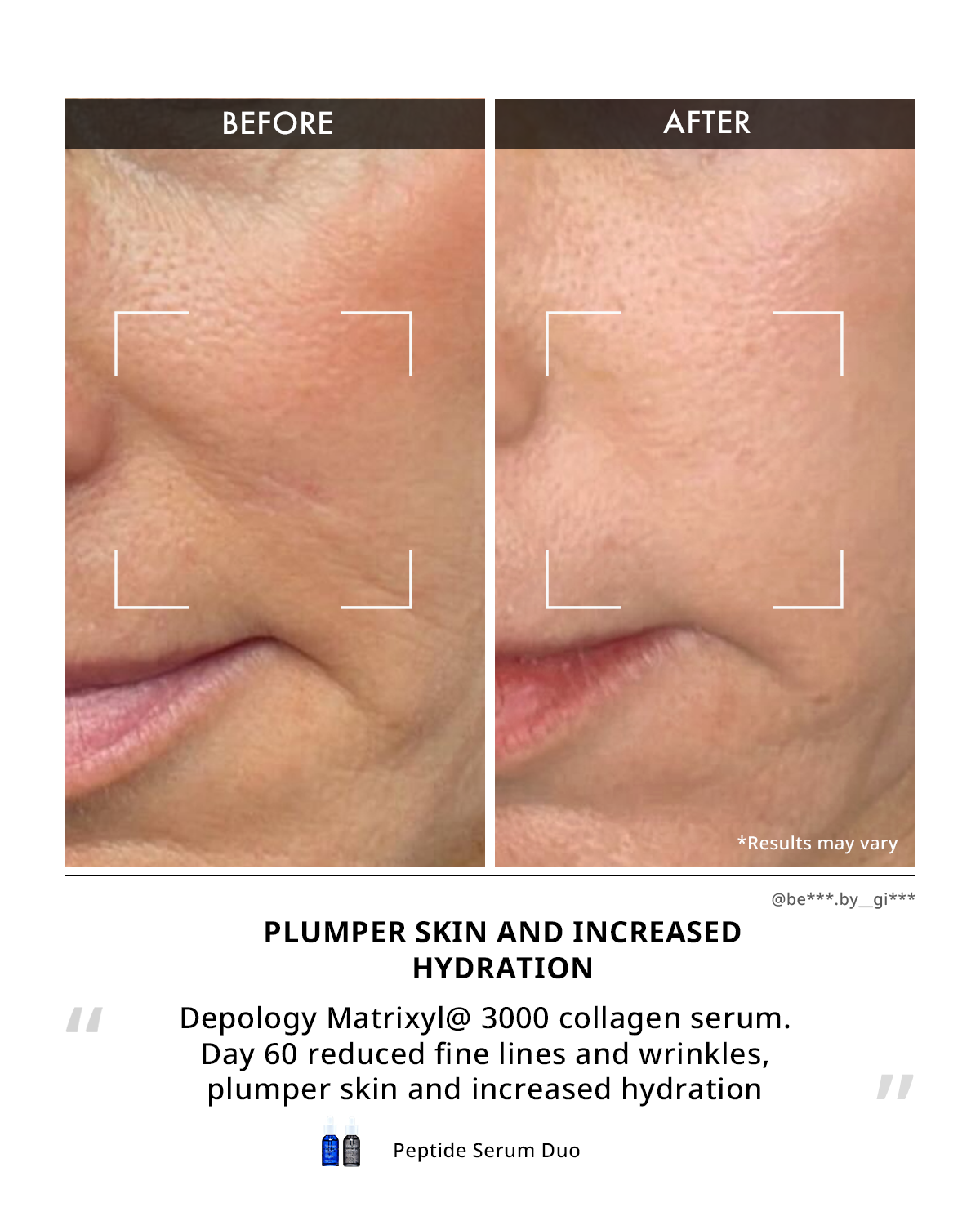 Matrixyl® 3000 Collagen Serum