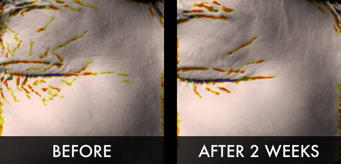 Clinical trial image