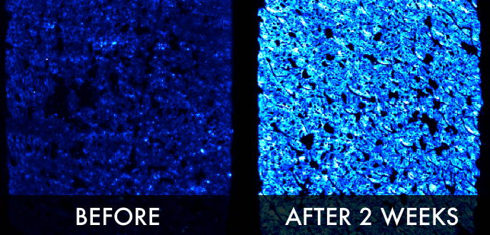 Clinical trial image