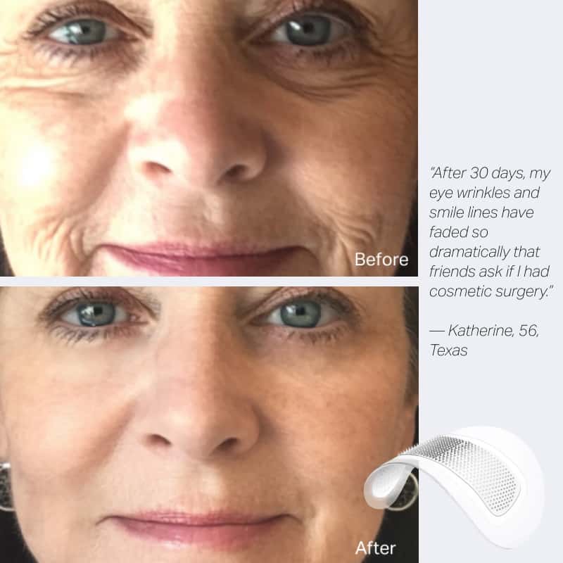 Deepcare+ Serum-Infused Micro Dart Patches