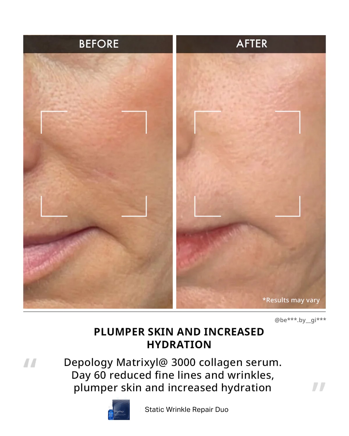 Static Wrinkle Repair Duo