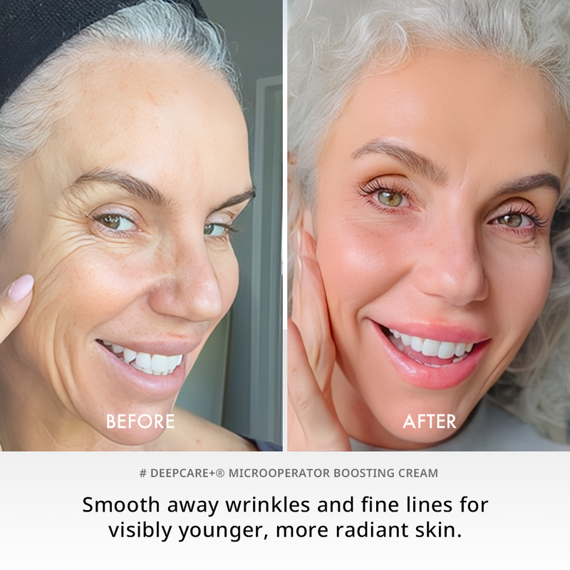 Deepcare+® MicroOperator Boosting Cream - Beginner
