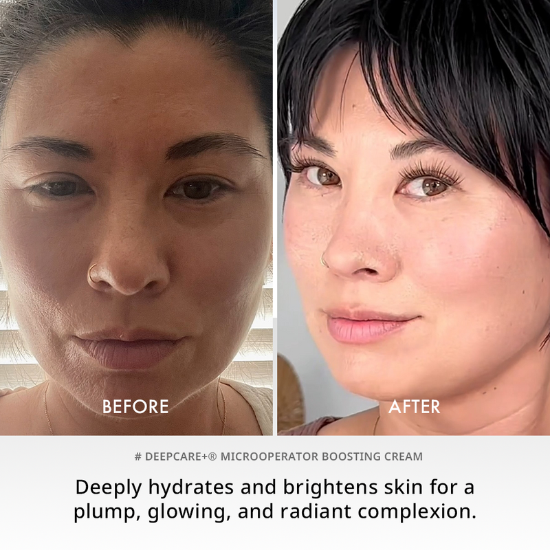 Deepcare+® MicroOperator Boosting Cream - Beginner