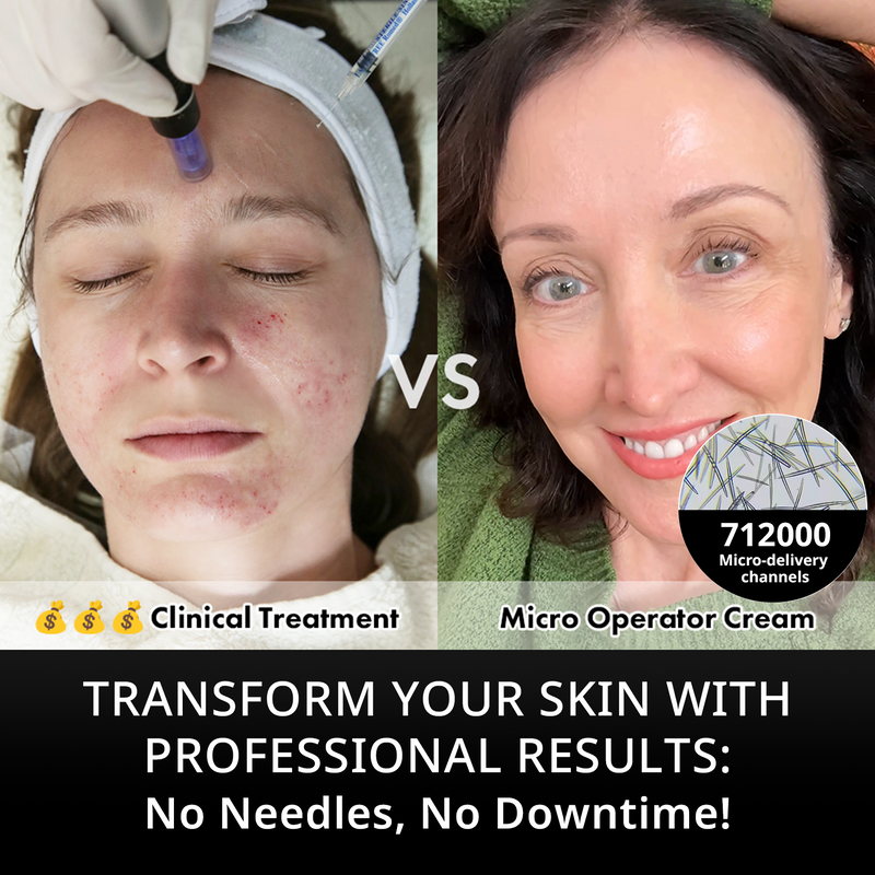 Deepcare+® MicroOperator Boosting Cream - Beginner