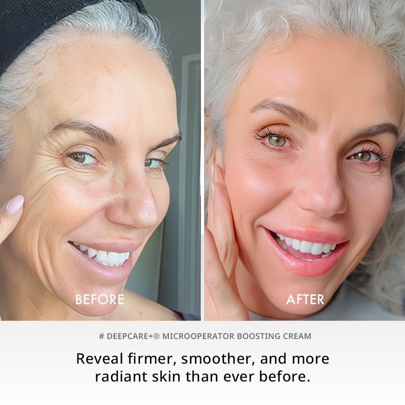 Deepcare+® MicroOperator Boosting Cream - Beginner