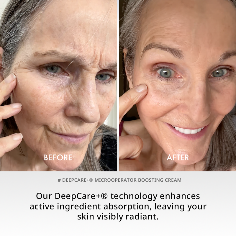 Deepcare+® MicroOperator Boosting Cream - Beginner