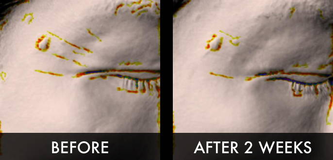 Clinical trial image