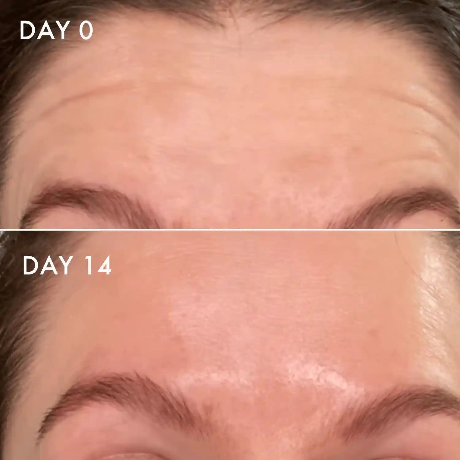 Minimal Line Peptide Serum Duo
