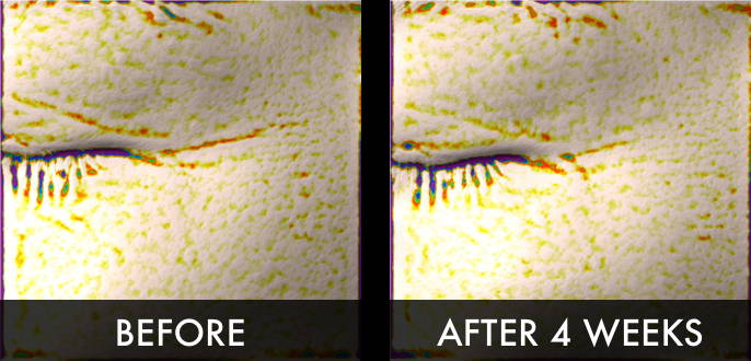 Clinical trial image