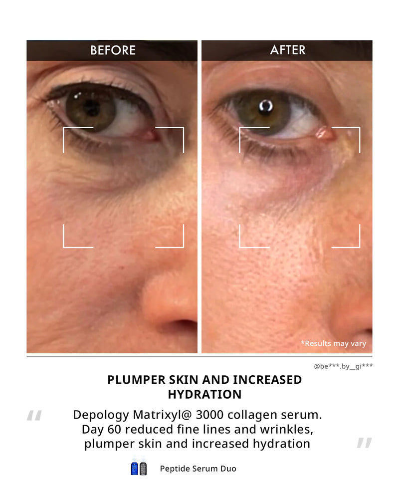 Line Eraser Peptide Serum Duo
