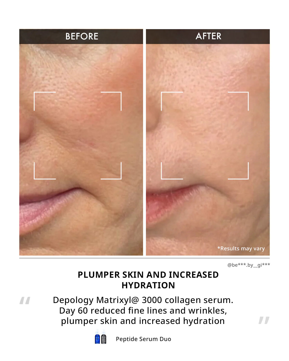 Minimal Line Serum Duo