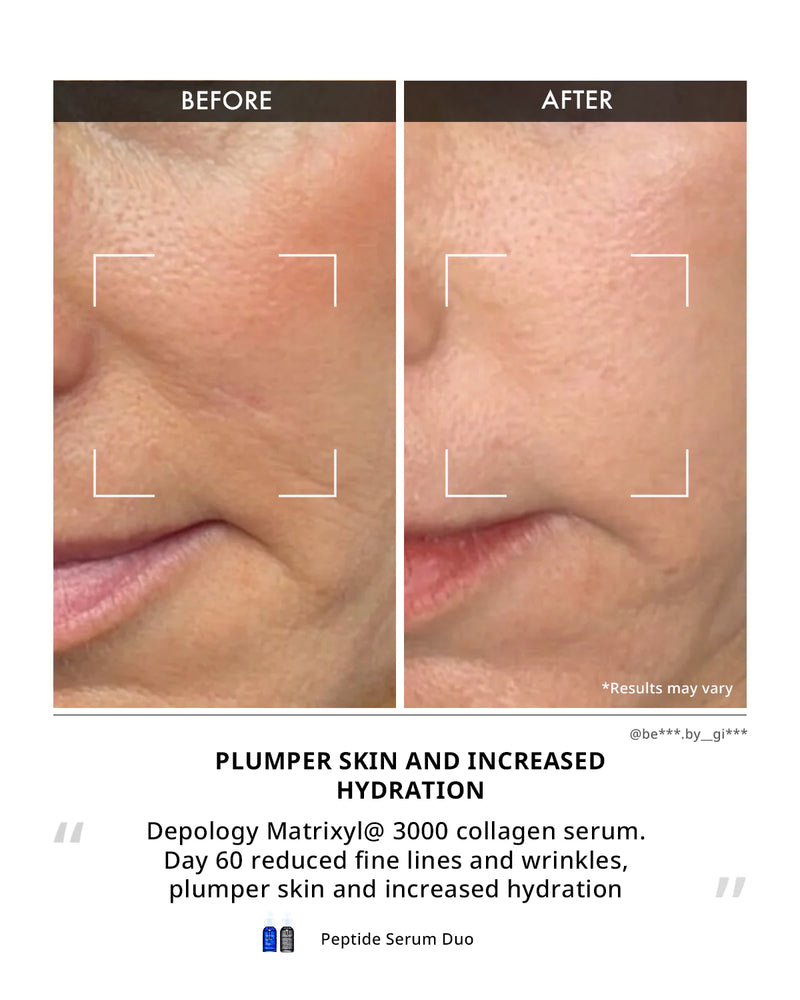 Line Eraser Peptide Serum Duo