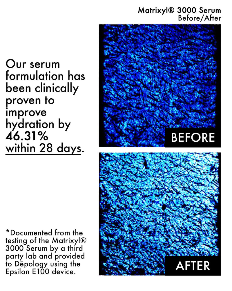 ADEL'S OFFER: Matrixyl® 3000 Collagen Serum