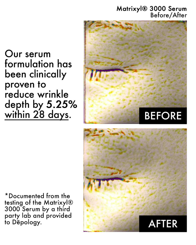 ADEL'S OFFER: Matrixyl® 3000 Collagen Serum