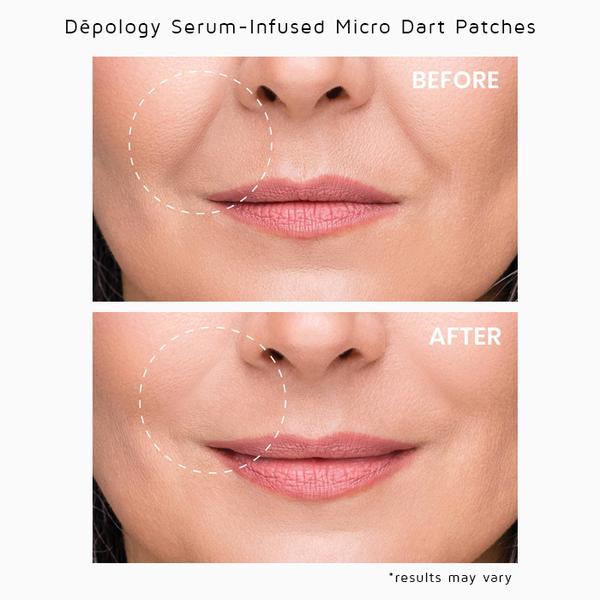 Deepcare Serum Infused Micro Dart Patches