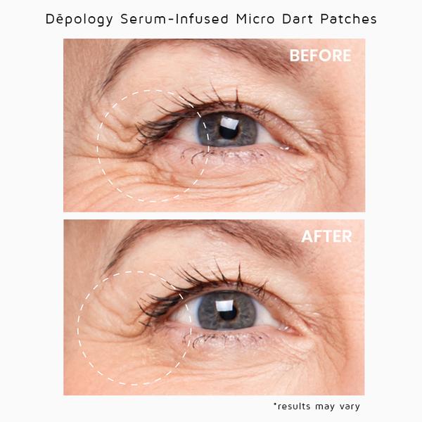 Deepcare + Serum Infused Micro Dart Patches